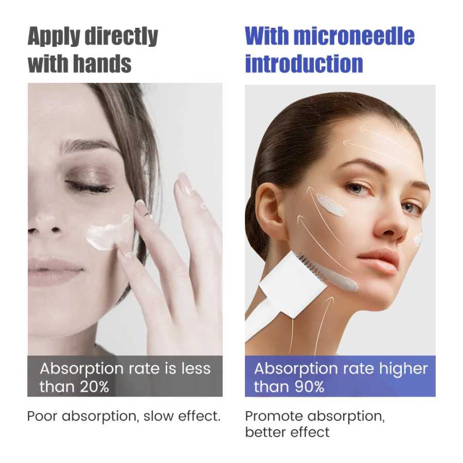Фотография №4 товара 140A/100A Derma Stamp Microneedling Роликовый массажер для лица Регулируемая титановая