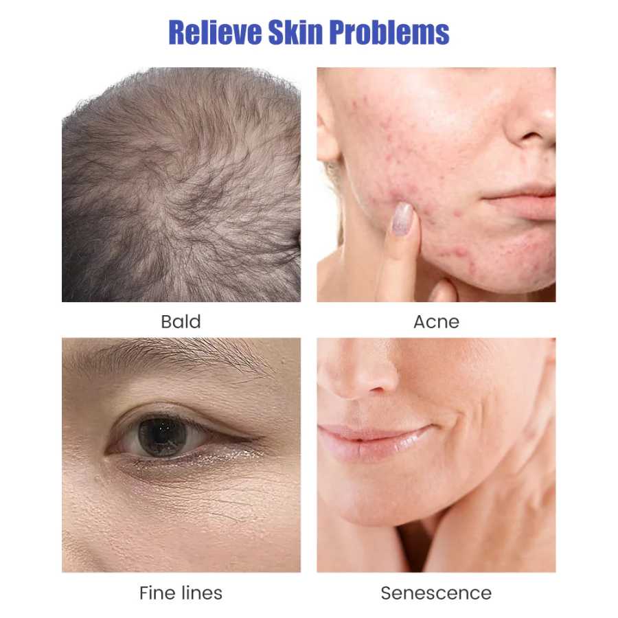Фотография №2 товара 140A/100A Derma Stamp Microneedling Роликовый массажер для лица Регулируемая титановая