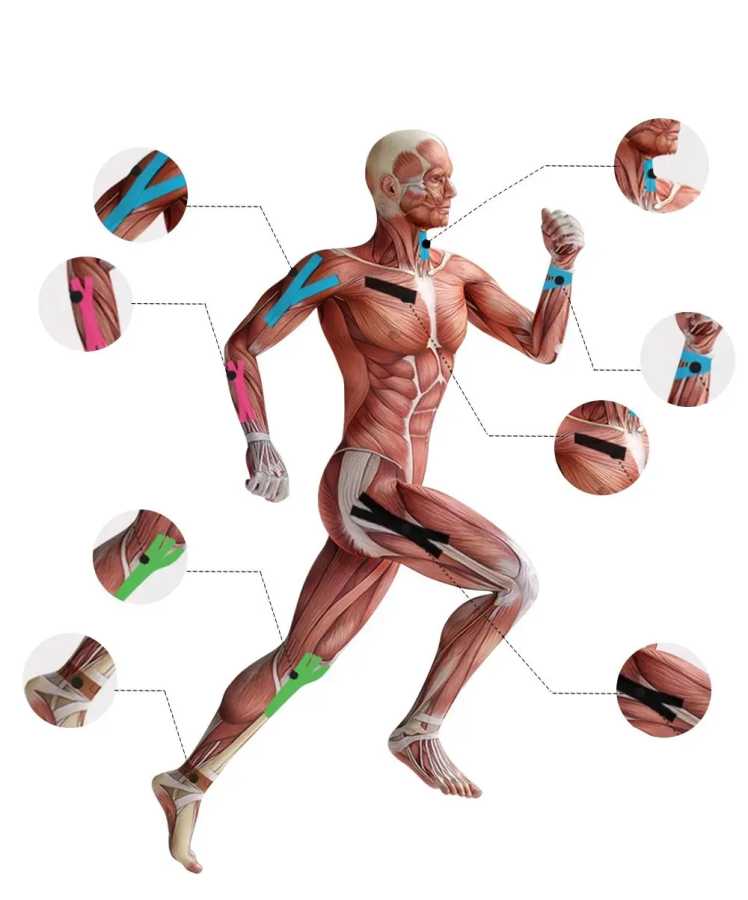 Фотография №3 товара Ленты Kinesio, эластичные бинты, наколенники, ленты, кинезиологические поддерживающие подушечки, фиксирующие