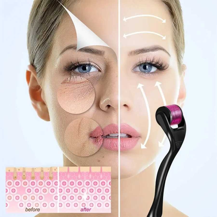 Фотография №4 товара Ролик Derma с микроиглами и титановыми иглами Удивительный инструмент для